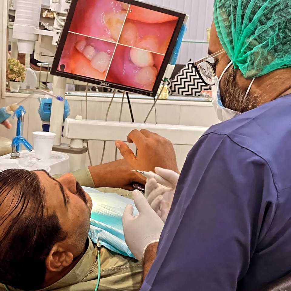 Close-up intraoral treatment at Smile Care Dental Clinic